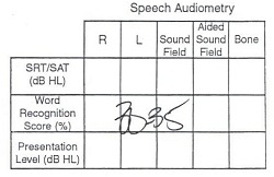 Audiogram-2008-12-22-st.jpg