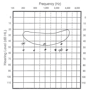 Audiogram-2008-12-22.jpg