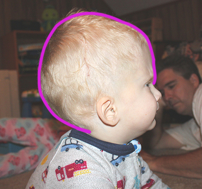 side-of-head-for-back.jpg