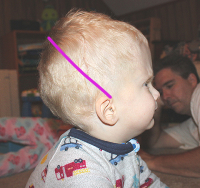 side-of-head.jpg